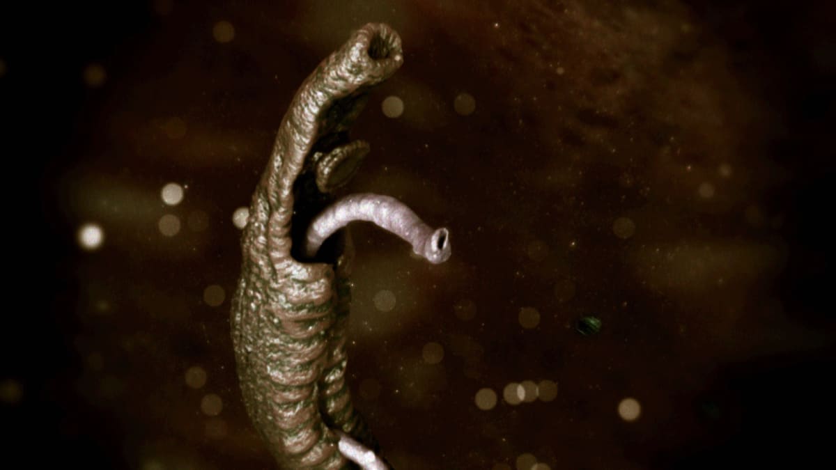 Six-and-a-Half Years of Agony - Monsters Inside Me | Animal Planet