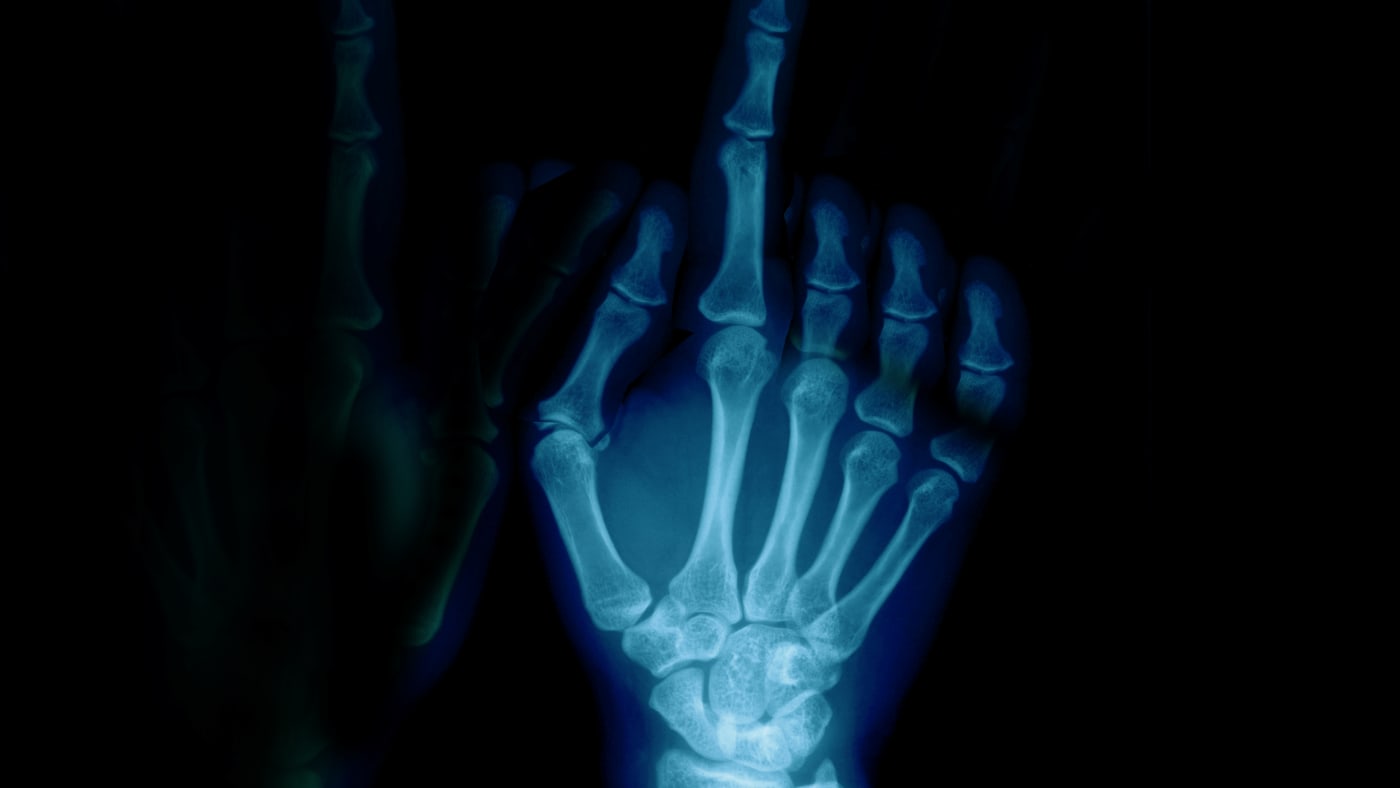 Diagnosis: Dead or Alive