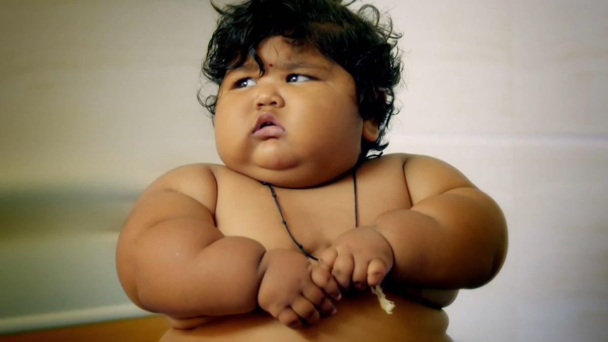 My 44Pound Baby Body Bizarre